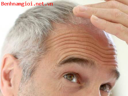 BoniHair – Giải pháp ưu việt cho người tóc bạc