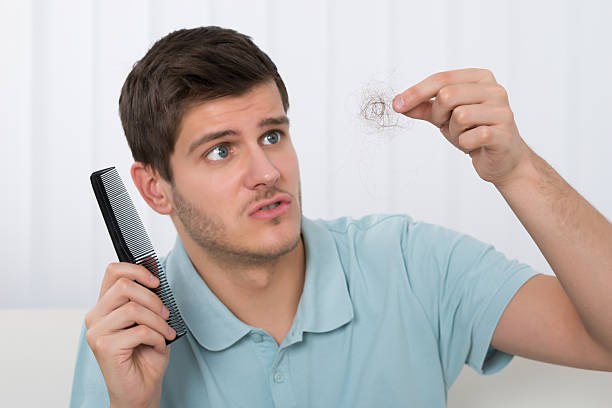 3 Nguyên nhân tóc rụng nhiều thường gặp ở nam giới và cách khắc phục hiệu quả