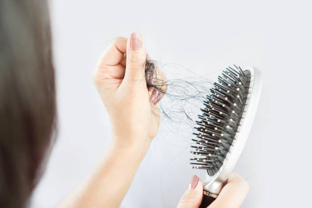 3 cách trị rụng tóc dân gian được áp dụng phổ biến – Đâu là giải pháp tối ưu?