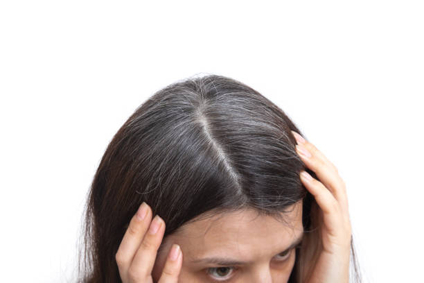 Tóc bạc sớm thiếu chất gì? Chế độ ăn uống khoa học cho người tóc bạc sớm